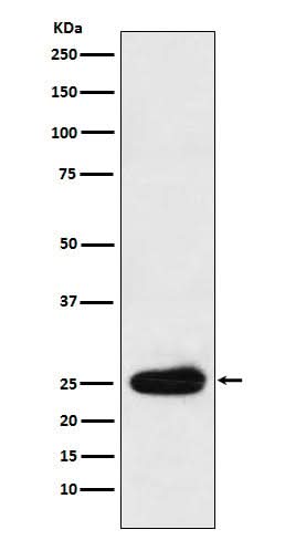 Anti-Kappa light chain Rabbit Monoclonal Antibody Boster Bio