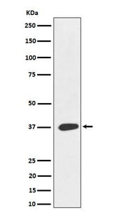 Anti-MAS1L Rabbit Monoclonal Antibody Boster Bio