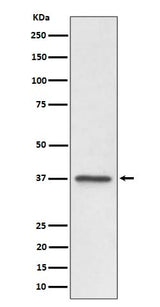 Anti-C3orf38 Rabbit Monoclonal Antibody Boster Bio