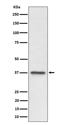 Anti-C3orf38 Rabbit Monoclonal Antibody Boster Bio