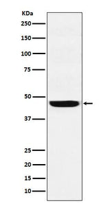 Anti-SEC61A Rabbit Monoclonal Antibody Boster Bio