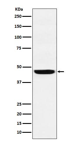 Anti-SEC61A Rabbit Monoclonal Antibody Boster Bio