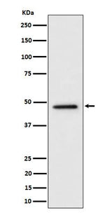 Anti-TOR4A Rabbit Monoclonal Antibody Boster Bio