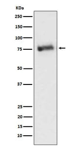 Anti-GRK3 Monoclonal Antibody Boster Bio