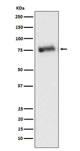 Anti-GRK3 Monoclonal Antibody Boster Bio