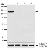 Anti-CRISPR-Cas9 Rabbit Monoclonal Antibody Boster Bio