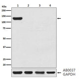 Anti-CRISPR-Cas9 Rabbit Monoclonal Antibody Boster Bio