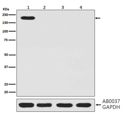 Anti-CRISPR-Cas9 SP Rabbit Monoclonal Antibody Boster Bio