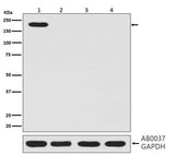 Anti-CRISPR-Cas9 SP Rabbit Monoclonal Antibody Boster Bio