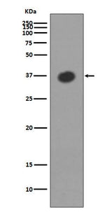 Anti-Maltose Binding Protein malE Rabbit Monoclonal Antibody Boster Bio