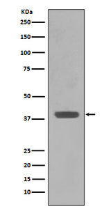 Anti-Maltose Binding Protein malE Rabbit Monoclonal Antibody Boster Bio