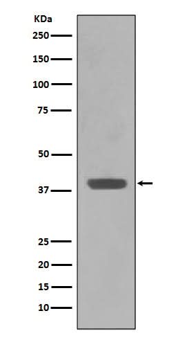 Anti-Maltose Binding Protein malE Rabbit Monoclonal Antibody Boster Bio