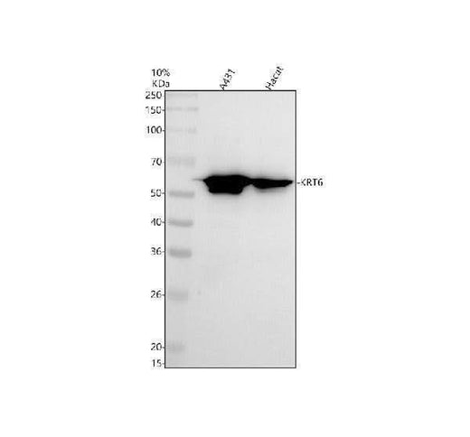 Anti-Cytokeratin 6 Rabbit Monoclonal Antibody Boster Bio
