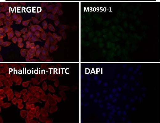 Anti-EpCAM/Trop1 Rabbit Monoclonal Antibody Boster Bio