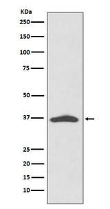 Anti-EpCAM/Trop1 Rabbit Monoclonal Antibody Boster Bio