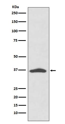 Anti-EpCAM/Trop1 Rabbit Monoclonal Antibody Boster Bio