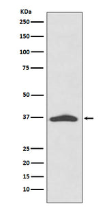Anti-EpCAM/Trop1 Rabbit Monoclonal Antibody Boster Bio