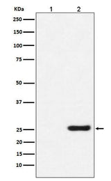 Anti-GST-Tag Mouse Monoclonal Antibody Boster Bio