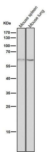 Anti-NELFB Rabbit Monoclonal Antibody Boster Bio