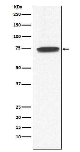 Anti-GCYA3 Rabbit Monoclonal Antibody Boster Bio