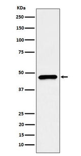 Anti-CECR5 Rabbit Monoclonal Antibody Boster Bio