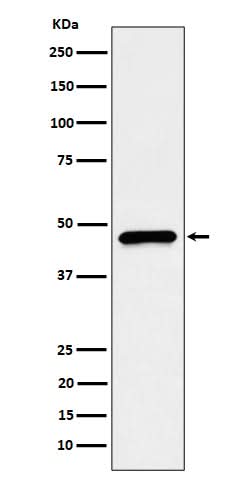 Anti-CECR5 Rabbit Monoclonal Antibody Boster Bio