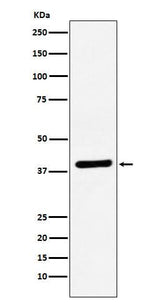 Anti-VEGFD Rabbit Monoclonal Antibody Boster Bio
