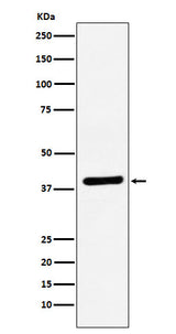 Anti-VEGFD Rabbit Monoclonal Antibody Boster Bio