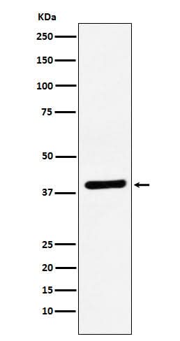 Anti-VEGFD Rabbit Monoclonal Antibody Boster Bio