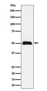 Anti-CCDC98 Rabbit Monoclonal Antibody Boster Bio