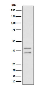 Anti-UFD1L Rabbit Monoclonal Antibody Boster Bio