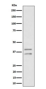 Anti-UFD1L Rabbit Monoclonal Antibody Boster Bio