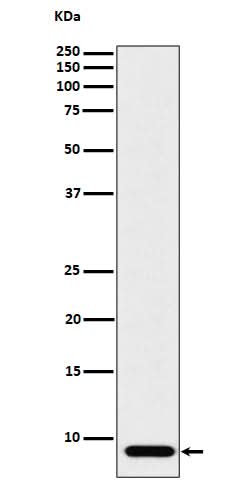 Anti-ATP5G1 Rabbit Monoclonal Antibody Boster Bio