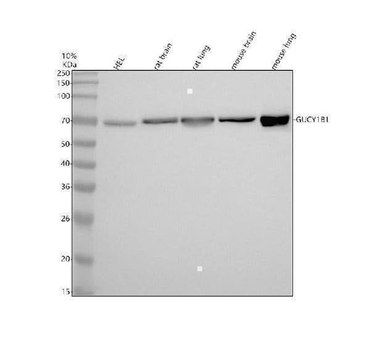 Anti-Guanylyl Cyclase beta 1 Rabbit Monoclonal Antibody Boster Bio