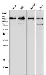 Anti-MGEA5 Rabbit Monoclonal Antibody Boster Bio