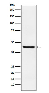 Anti-Septin 2 Rabbit Monoclonal Antibody Boster Bio