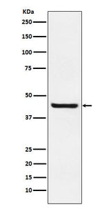 Anti-Septin 2 Rabbit Monoclonal Antibody Boster Bio
