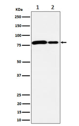Anti-MMUT Rabbit Monoclonal Antibody Boster Bio
