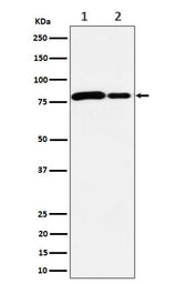 Anti-MMUT Rabbit Monoclonal Antibody Boster Bio