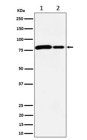 Anti-MMUT Rabbit Monoclonal Antibody Boster Bio