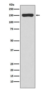 Anti-RNA polymerase beta Rabbit Monoclonal Antibody Boster Bio