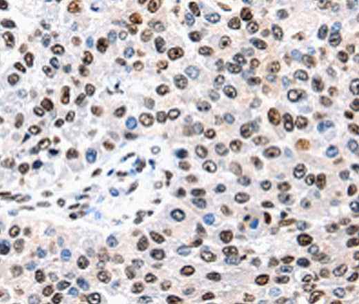 Anti-Human/Mouse/Rat AQP2 Antibody