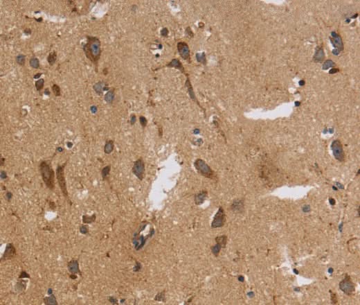 Anti-Human ITPR3 Antibody - ABMIUM