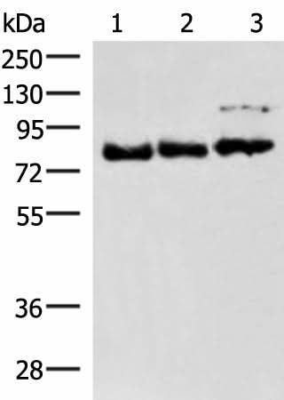 Western blot analysis of 231 A172 and HepG2 cell lysates using FOXK2 Polyclonal Antibody at dilution of 1:800