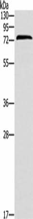 Western blot analysis of Jurkat cells using ZAP70 Polyclonal Antibody at dilution of 1:1000