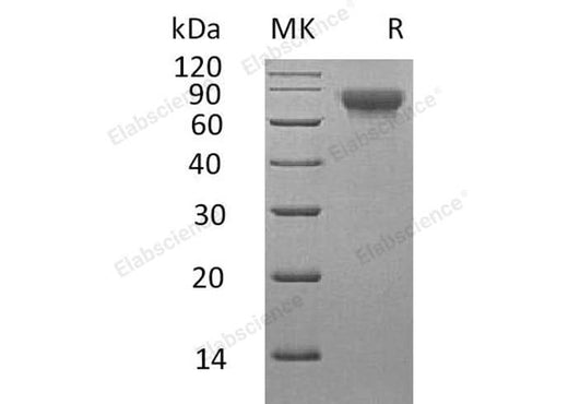Recombinant Human SLAMF3/CD229 Protein (His Tag) - ABMIUM