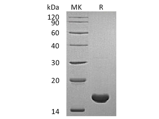 Recombinant Human Cyclophilin A Protein - ABMIUM