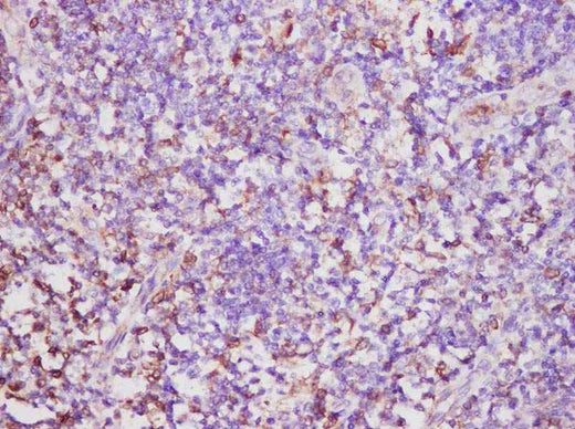 Anti-Human CD74 Antibody - ABMIUM