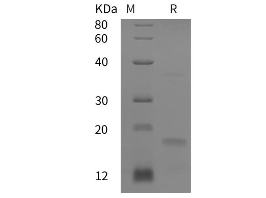SDS-PAGE analysis of Human P21 proteins, 2 μg/lane of Recombinant Human P21 proteins was resolved with SDS-PAGE under reducing conditions, showing bands at 18 kDa.