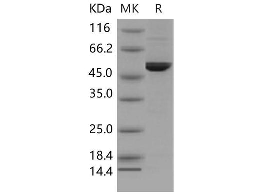Recombinant Mouse DOPA Decarboxylase/DDC Protein (His Tag) - ABMIUM